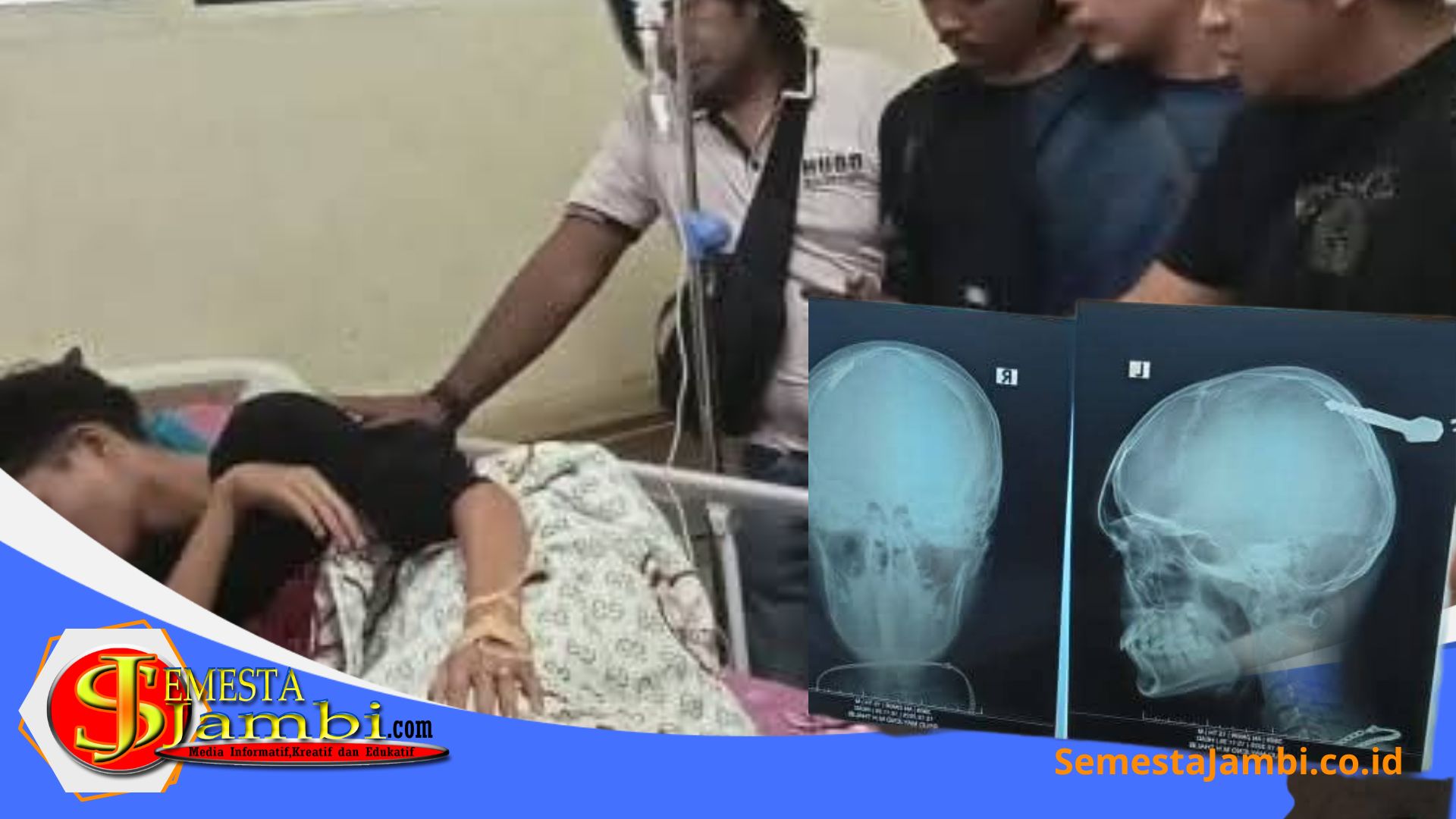 Pelajar Sungai Penuh Korban Pengeroyokan Dirawat Intensif Di Rumah Sakit